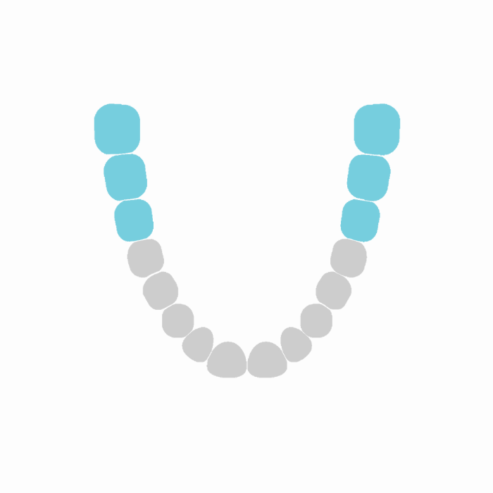 Third Molars & molars lower diagram