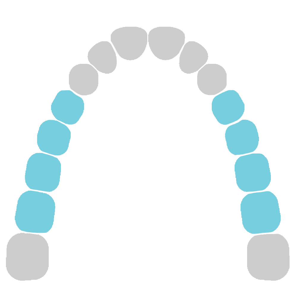 Upper molars, biscuspids & roots