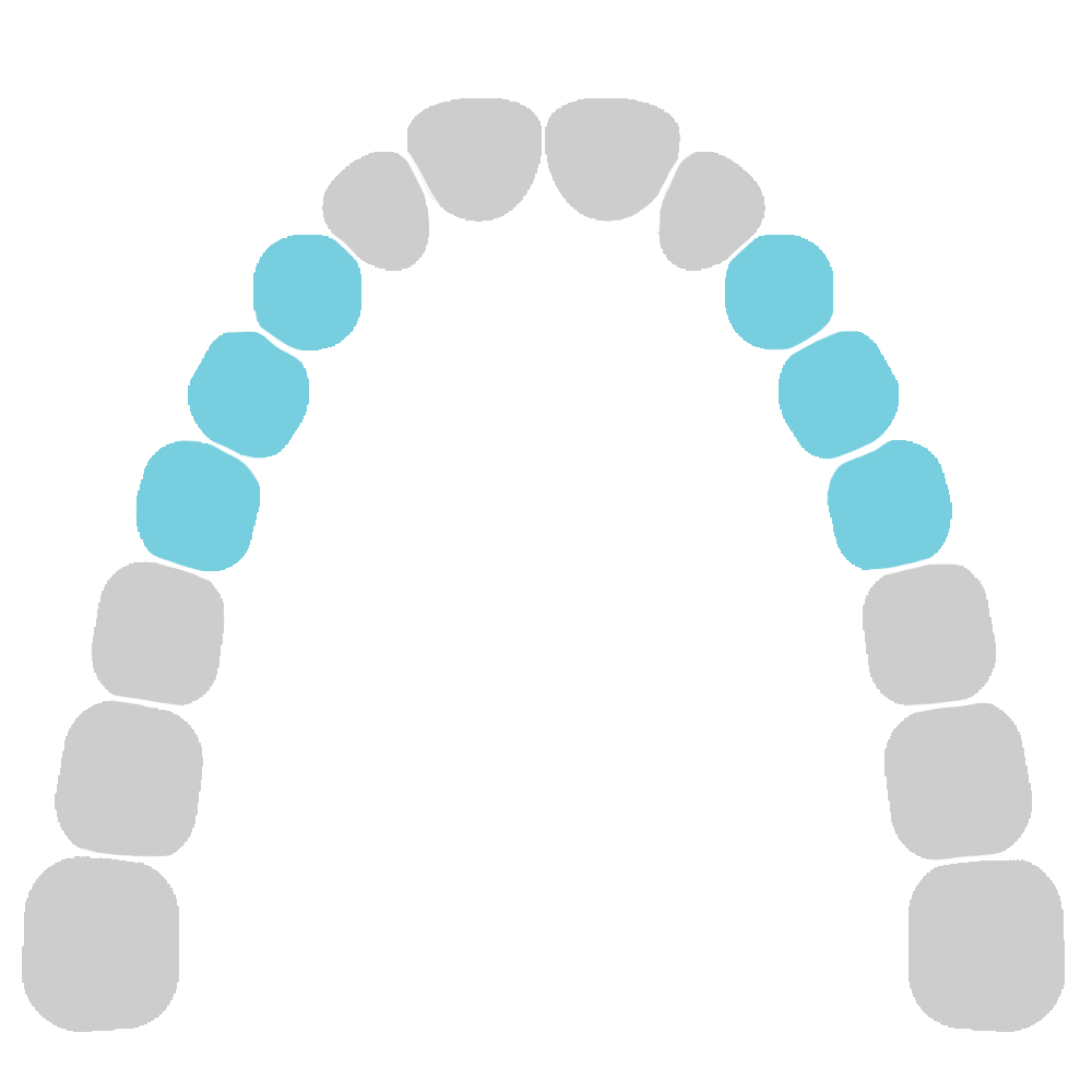 3,4,5 upper jaw diagram