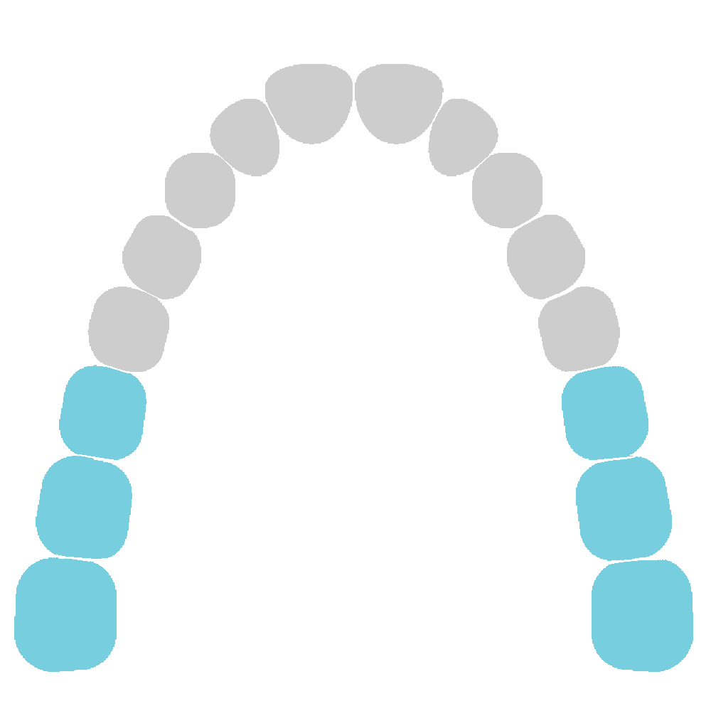 Third Molars