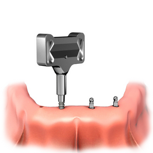 Butteryfly Driver tightening mini dental implants